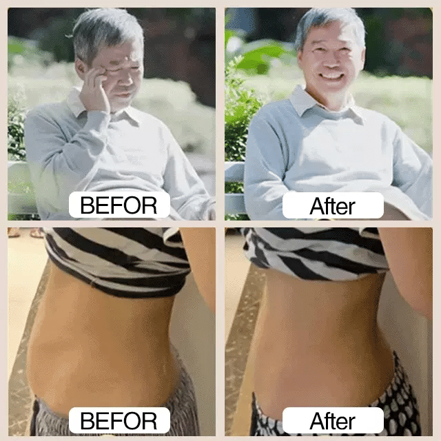 Sugar Control LI4 Acupressure Point Clip PACK OF TWO